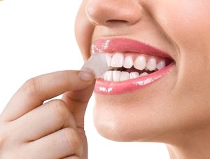 After Removing the Teeth Strips