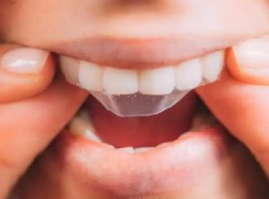 Applying the Teeth Strips